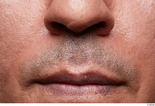 HD Face Skin Nadheer Wakim face lips mouth nose skin…